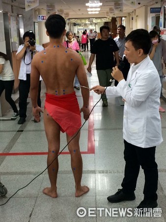 台東醫院舉辦中醫師揭開「針灸的面紗」記者會，教導民眾針灸、推拿的功效。（圖／台東醫院提供）