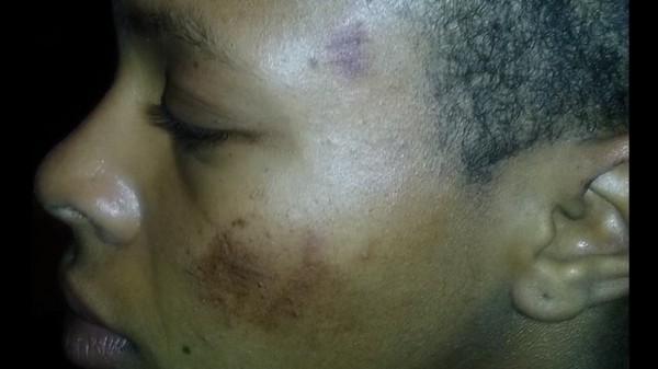 ▲▼19歲少女塔吉亞娜被誤認是「持刀禿黑男」，遭到警方暴打和放狗咬傷。（圖／翻攝自NAACP臉書粉絲專頁影片）