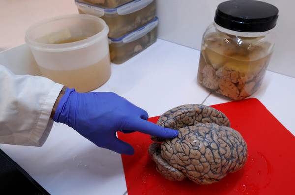 ▲▼比利時迪弗爾(Duffel)醫院擁有3000多顆人腦標本。（圖／路透社）