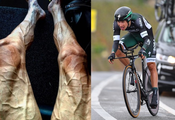 ▲波蘭選手波賈斯基（Pawel Poljanski）參加2017環法自行車賽，雙腳彷彿佈滿蚯蚓。（組合圖左／翻攝自Pawel Poljanski臉書，圖右／CFP）