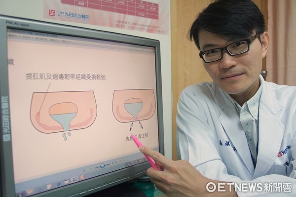 ▲光田綜合醫院婦產部醫師蘇棋輔助改善病患輕微漏尿狀況。（圖／光田綜合醫院提供）