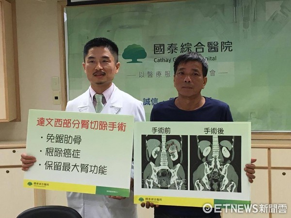 ▲抽菸傷的不只肺,還會導致腎臟癌。(圖/記者嚴云岑攝)