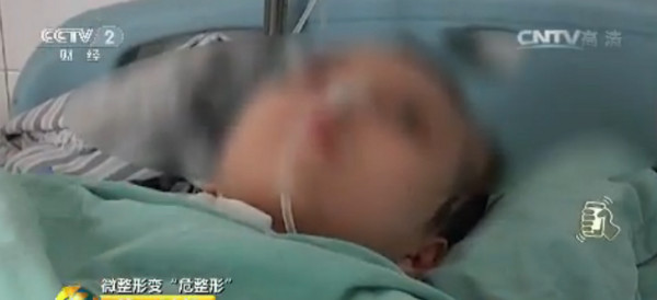 ▲▼廣西南寧27歲女子小曼微整形，導致身體左半邊偏癱。（圖／翻攝自《央視》）