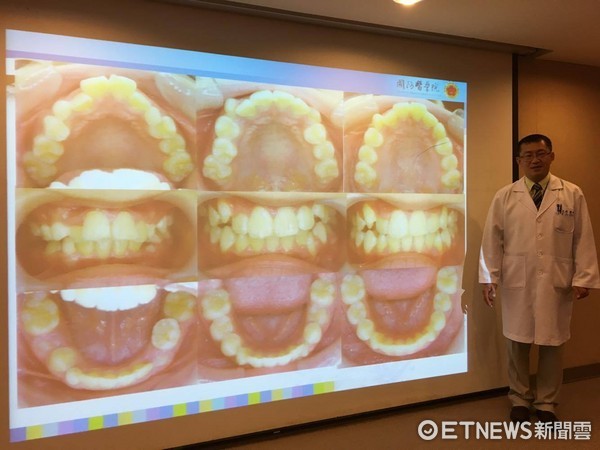▲三軍總醫院齒顎矯正科、兒童牙科主任李忠興。（圖／記者嚴云岑攝）