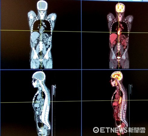 ▲4D高階正子電腦斷層掃描儀(PETCT)可提供高解析度影像。（圖／記者林悅翻攝）