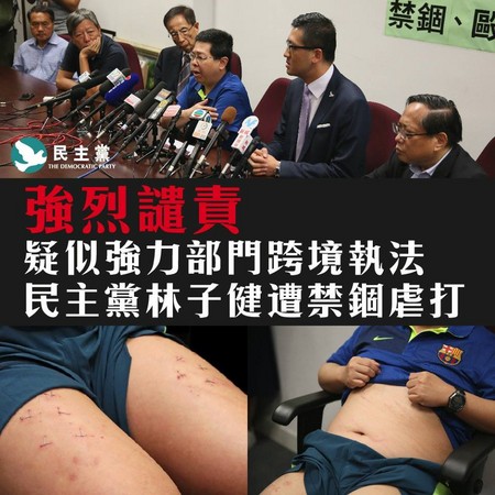香港民主黨員林子健疑遭擄人恐嚇。（圖／翻攝民主黨臉書）