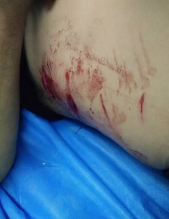 ▲中國男子上山採藥遭黑熊襲擊。（圖／翻攝自陸網）