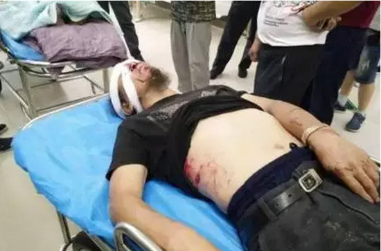 ▲中國男子上山採藥遭黑熊襲擊。（圖／翻攝自陸網）