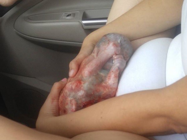 ▲美國孕婦斯科理生產時，兒子罕見羊膜未破。（圖／翻攝自Raelin Scurry Instagram）