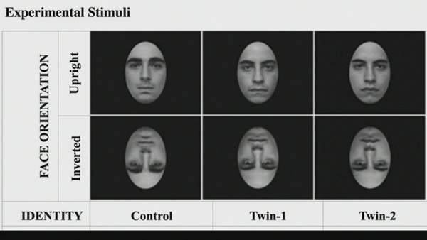 雙胞胎：截自獲獎科學研究〈這是我還是我的雙胞胎兄弟？同卵雙胞胎難已從視覺認知中分別彼此差異〉