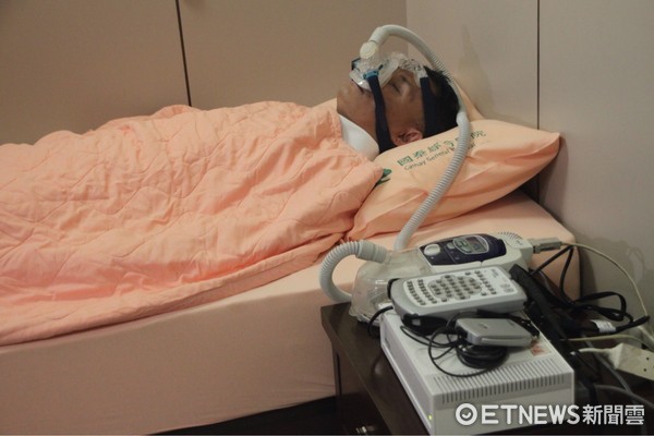 ▲呼吸中止症治療。（圖／國泰醫院提供）