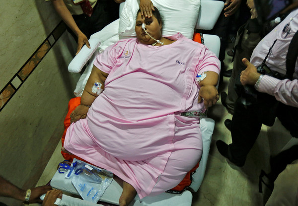 ▲▼世界最胖女艾提(Eman Ahmed Abd El Aty)於阿布達比的醫院病逝。（圖／CFP）