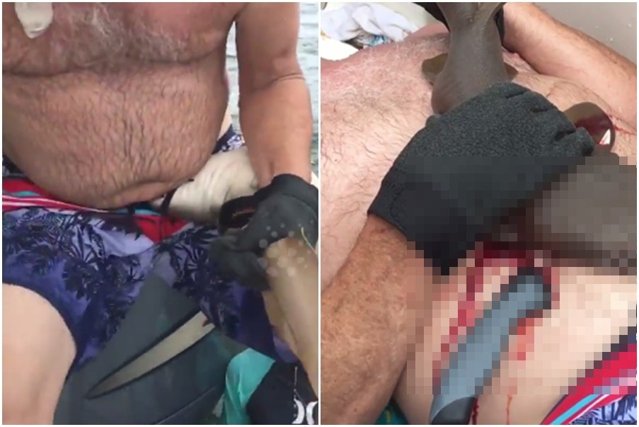 ▲美國男子麥卡提（Ervin Maccarty）在馬拉松海岸（Marathon）潛水時，遇上一隻迷你鯊魚突襲狠咬他的腹部。（圖／翻攝自YouTube）