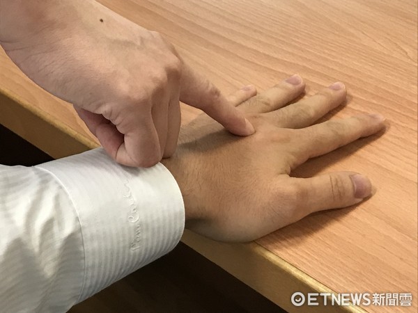 高血壓年輕化，中醫輔助降血壓。（圖／台北慈濟醫院提供）