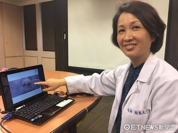 ▲書田診所皮膚科主任鄭惠文。（圖／記者嚴云岑攝）