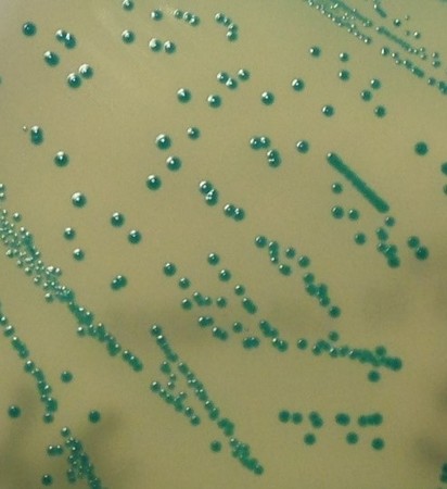 ▲▼李斯特菌選擇性呈色培養基生長的菌落 。（圖／疾管署提供）