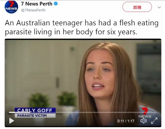 少女吃生魚染寄生蟲　「牠有牙齒！痛到像肌肉被撕開」。（圖／翻攝自7 News Perth的推特）