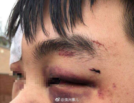 ▲▼中國留澳學生被圍毆。（圖／翻攝自澳洲事兒微博）