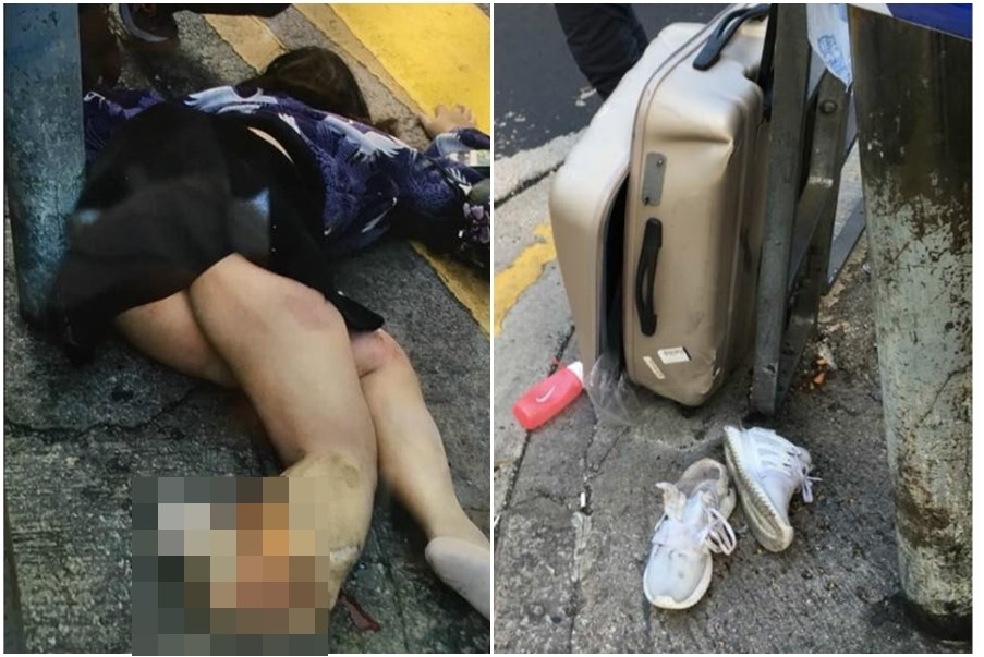 ▲香港旺角一名19歲女遊客被巴士撞倒，右腳腳踝部位被輾斷。（圖／翻攝自香港突發事故報料區臉書）