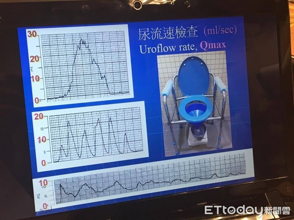 ▲▲書田診所泌尿科主任洪峻澤。（圖／記者嚴云岑攝)