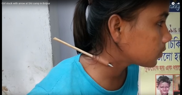▲▼ 印度少女被箭刺穿。（圖／翻攝自Youtube）