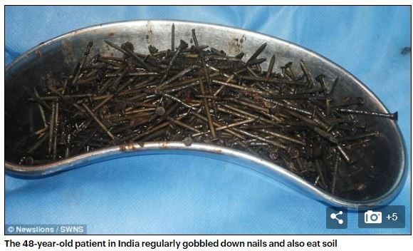 ▲▼印度男子胃裡發現639根鐵釘。（圖／翻攝自DailyMail）