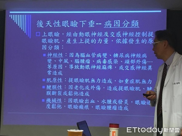 ▲沒睡飽？左側眼瞼突下垂　50歲男意外揪出「腦中風」。（圖／記者嚴云岑攝）