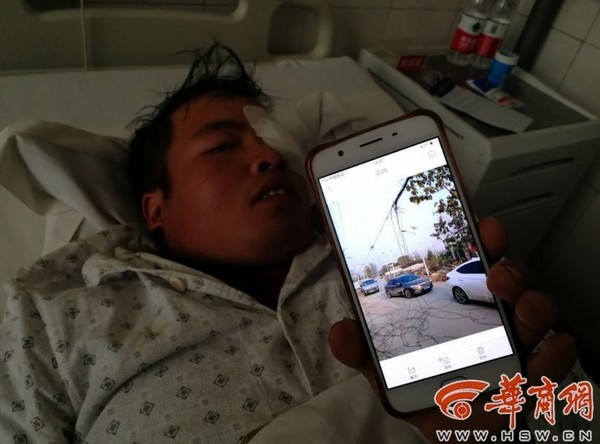 ▲▼陝西27歲男子騎車上班，被墜落電纜劃傷眼球穿孔。（圖／翻攝自華商報）