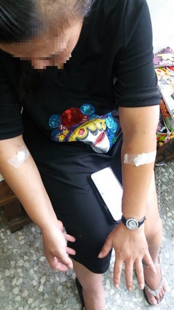 吸毒10年，潘女手上滿是針孔，已經「走水路」了！（警方提供）