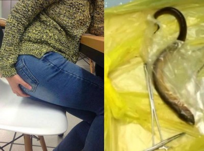 肥硕「黄鳝」爆菊.活跳钻腹部 男拒讲原因.网暗笑:老司机