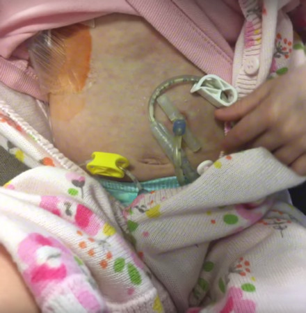 ▲ 英國2歲女童波比接受化療，小小身體插滿管子  。（圖／翻攝自YouTube）