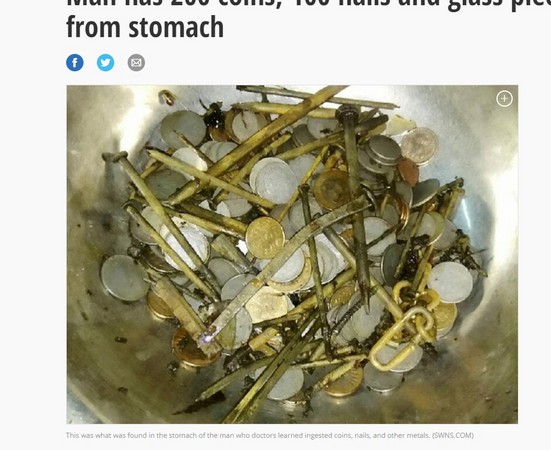 ▲▼印度男子馬庫蘇汗(Maksud Khan)迷上吃金屬，胃裡藏100根釘子263枚硬幣。（圖／翻攝自英國媒體SWNS）