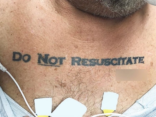 ▲胸前刺青Do not resuscitate。（圖／翻攝自New England Journal of Medicine）