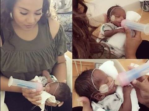 ▲▼經過一連串的手術，小男嬰也漸漸恢復健康。（圖／臉書／Linette Dickey）