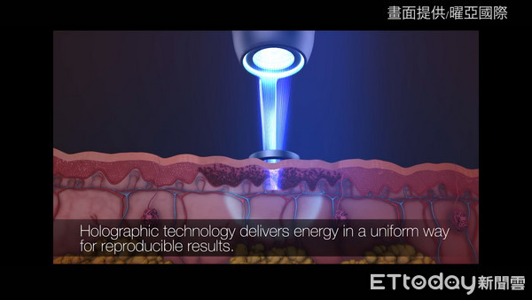 ▲全像皮秒雷射療程夯  醫師：可改善肌膚老化問題。（圖／記者謝婷婷攝）