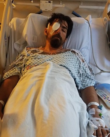 右眼後方像被撞擊！29歲男無預警中風　腦斷層：顱腔全被血填滿。(圖／取自reddit)