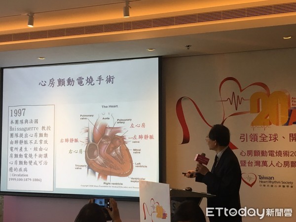 ▲心房顫動。（圖／記者嚴云岑攝）
