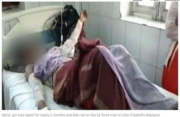 ▲▼ 印度北方邦（Uttar Pradesh）一名少女被3男輪姦性侵將近2個月，但就在她鼓起勇氣報警之後，卻慘遭他們淋油放火報復，導致她全身40%燒傷。（圖／翻攝自NDTV）