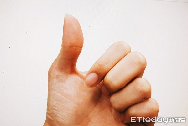 ▲大拇指,手示意圖。（圖／資料照）