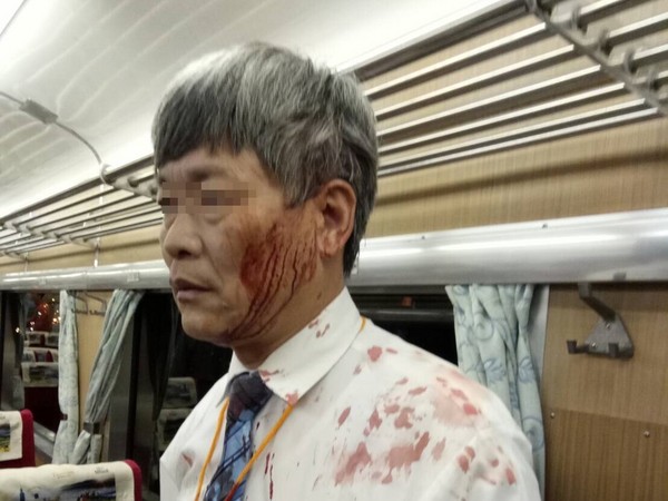 ▲▼ 台鐵列車長遭旅客持酒瓶攻擊頭部見血 。（圖／台鐵提供）