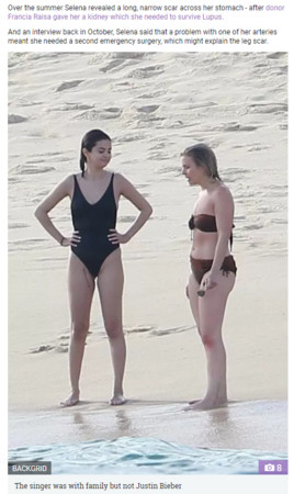 ▲▼賽琳娜大腿留10cm開刀疤痕（圖／翻攝自《太陽報》）