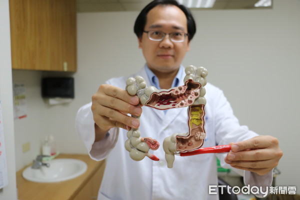 ▲醫師呼籲，若三等親內有罹患大腸癌，要以罹癌親人中最小發病年齡為基準點，在該發病年齡前進行預防性檢查。（圖／羅東博愛醫院提供）