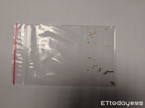 ▲54歲婦膀胱反覆感染2年多　竟是體內這條「線」惹禍。（圖／書田診所提供）