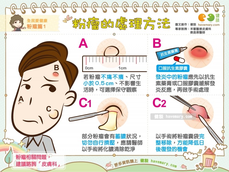 長粉瘤怎麼辦？1圖4方法教你怎治。（圖／健談授權提供）