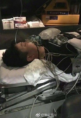 ▲▼峇里島染怪病亡　女子死因出爐。（圖／翻攝自重慶晨報微博）