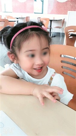 ▲▼廣東東莞一名3歲女童罹患胚胎型橫紋肌肉瘤，壓迫視神經導致右眼失明。（圖／翻攝自廣州日報）