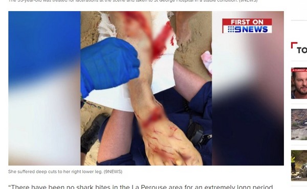 ▲▼澳洲雪梨一名女子在距離海岸線20公尺處遭大白鯊咬傷。（圖／翻攝自9NEWS）
