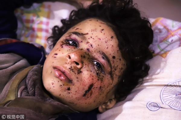 ▲▼UN敘利亞停火決議沒人理會，東古塔10歲男童眼中滿是絕望。敘利亞內戰。（圖／CFP）
