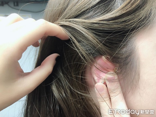 ▲揉耳朵可以變美示意圖。（圖／記者曹悅華攝）
