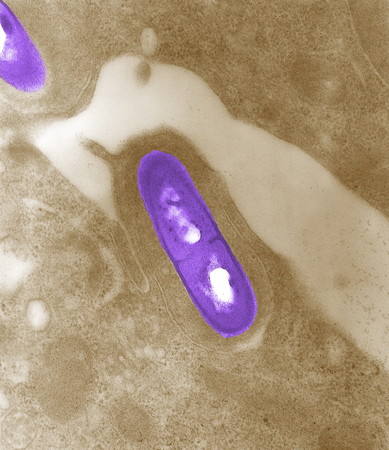 ▲▼李斯特菌(listeriosis)在南非造成180死亡。（圖／路透社）